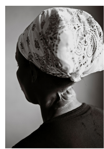 A woman scarred by a machete attack during Genocide. Photo/Alamy